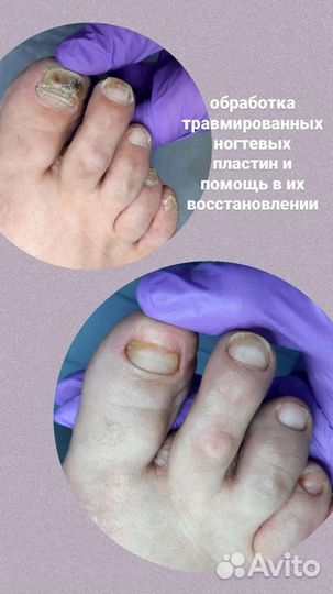 Педикюр / подолог