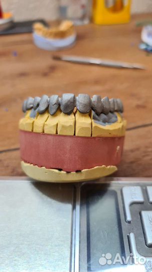 Зубной техник