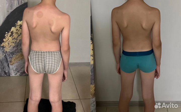 Остеопатия