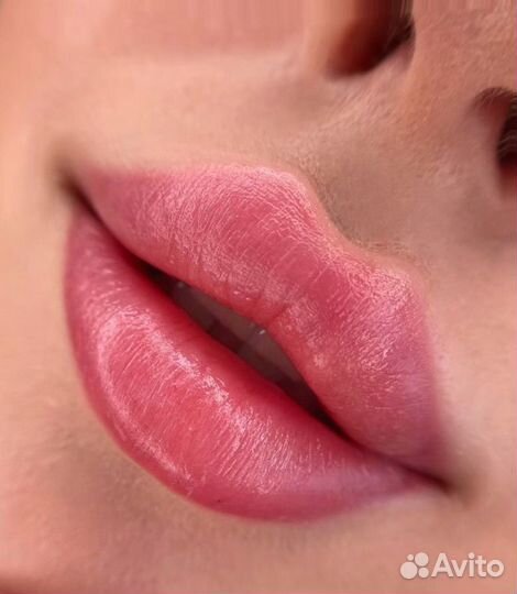 Аугментация губ, BioRepeelcl3, липолитик