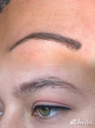 Удаление татуажа