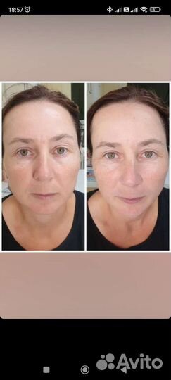 Комплексный уход против морщин NovAge Ecollagen