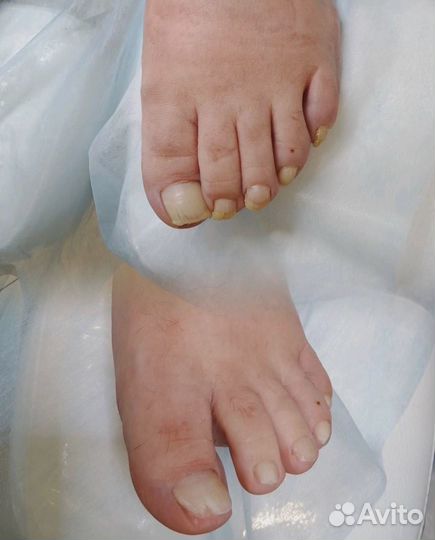 Услуги подолога, решение для проблемных ступней