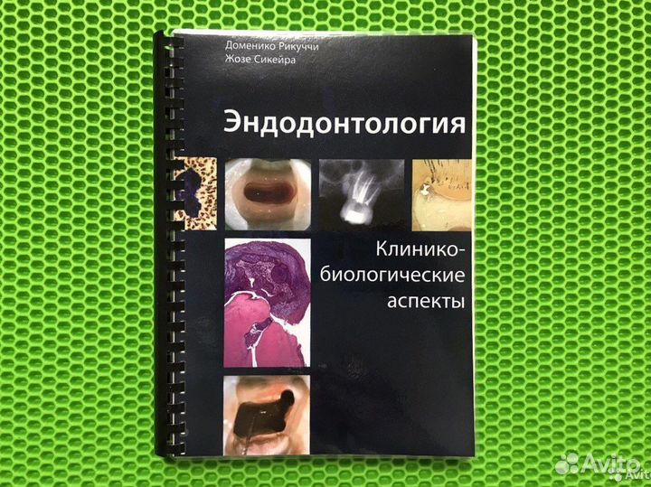 Эндодонтия Рикуччи