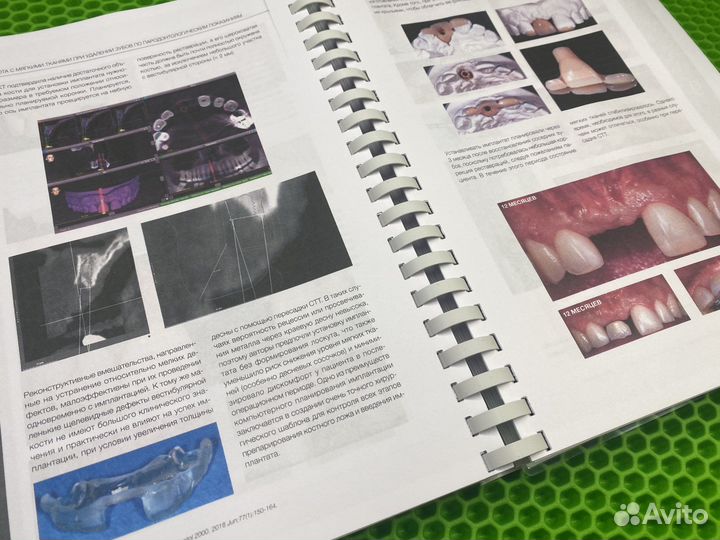 Пластическая хирургия мягких тканей. Зуккелли