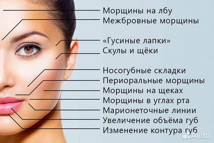 Ботулотоксин типа А