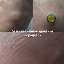 Подологический педикюр, Зеленоград