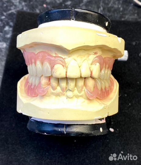 Съемные зубные протезы с выездом на дом. Зубы