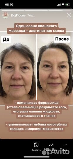 Массаж лица Кобидо, буккальный, гуаша, миофасц-й