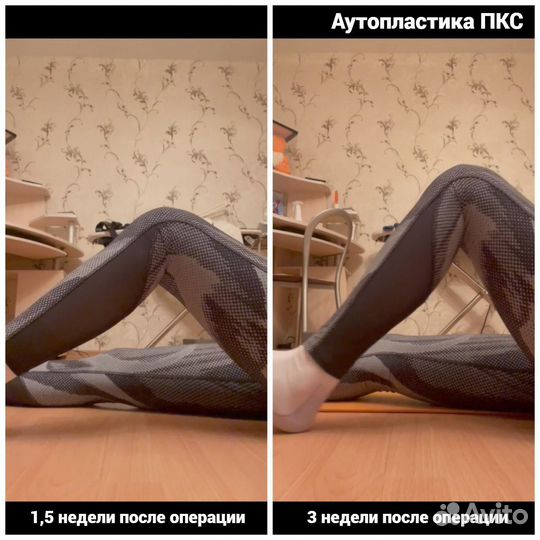 ЛФК / Реабилитация / Кинезиология