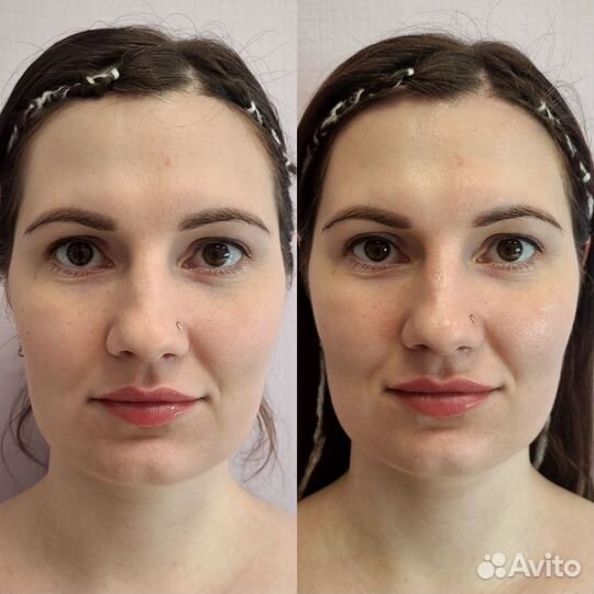 Массаж лица