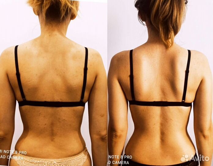 Массаж Челябинск (реабилитолог)