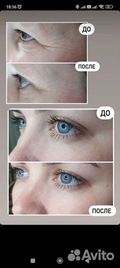 Комплексный уход против морщин NovAge Ecollagen