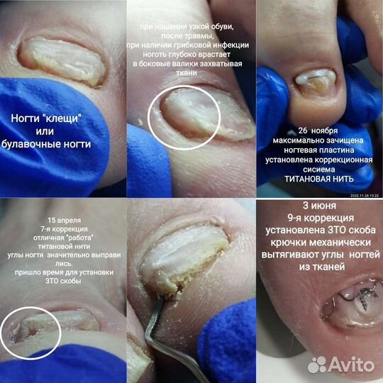 Подолог. Мастер-педикюра