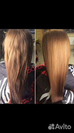 Ботокс,Нанопластика