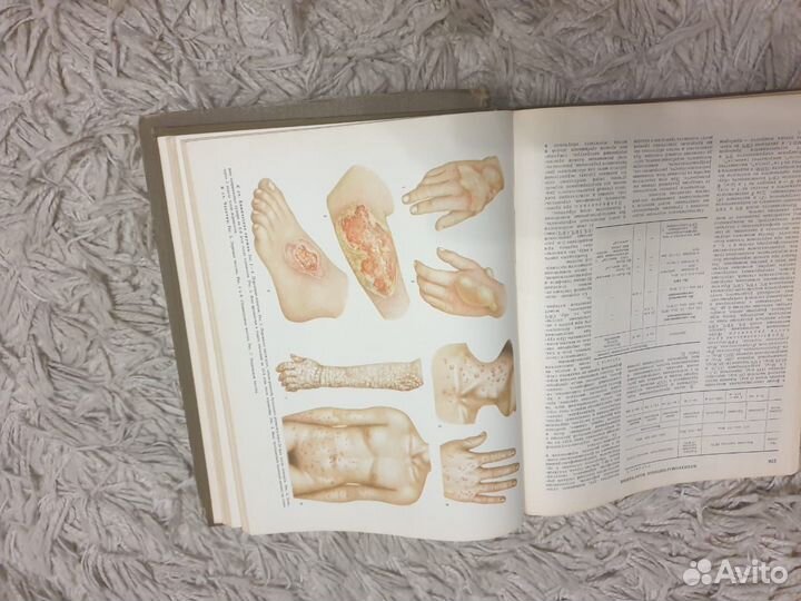 Продаётся краткая медицинская энциклопедия