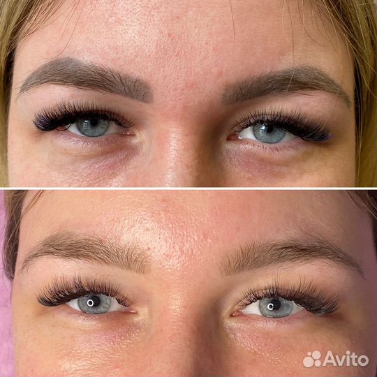 Осветление/ удаление тату/татуажа