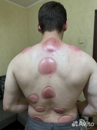 Массаж, (хиджама)обучение