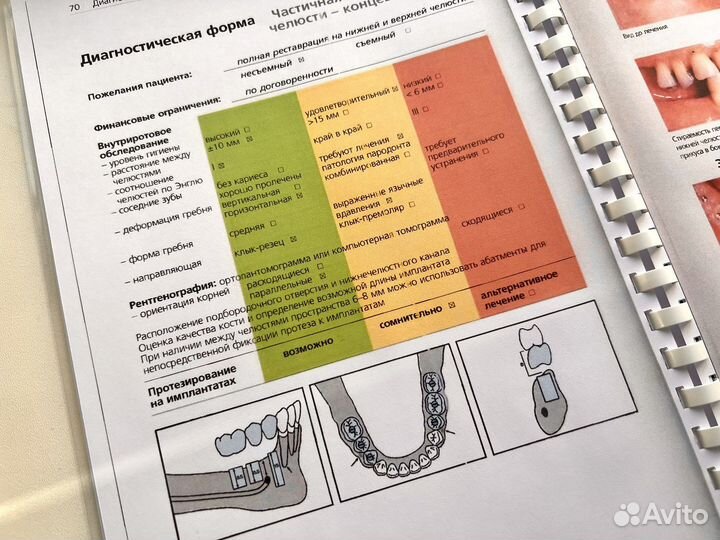 Стоматологическая реабилитация