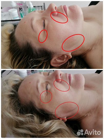 Массаж лица