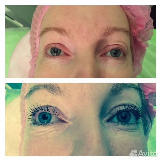 Ламинирование ресниц, ботокс ресниц