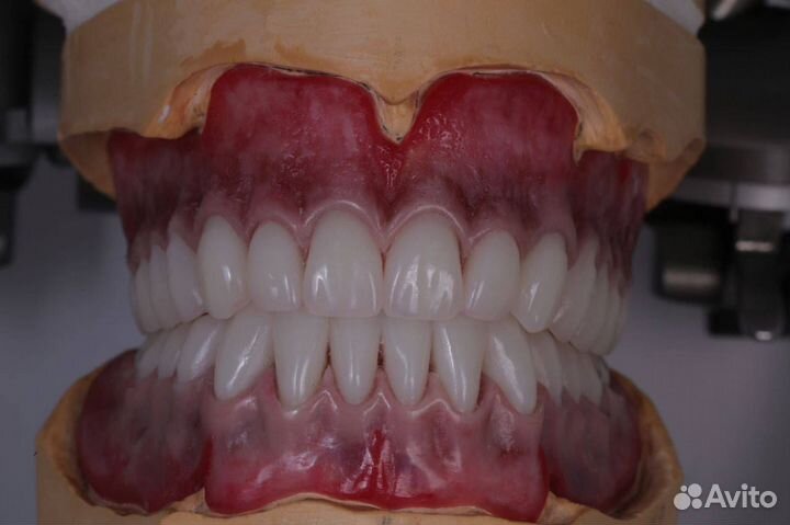 Услуги зубного техника