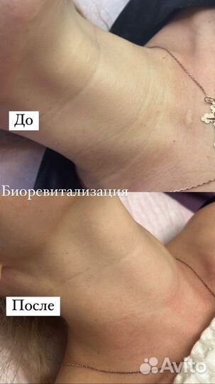 Услуги косметолога