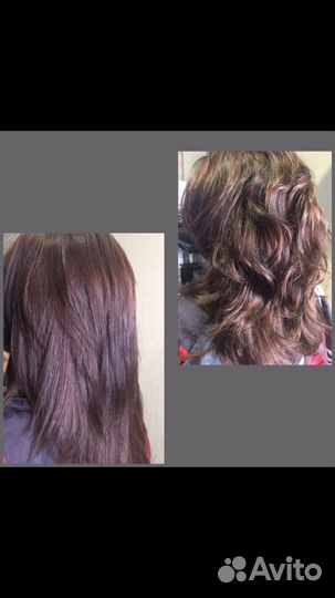 Ботокс,Нанопластика