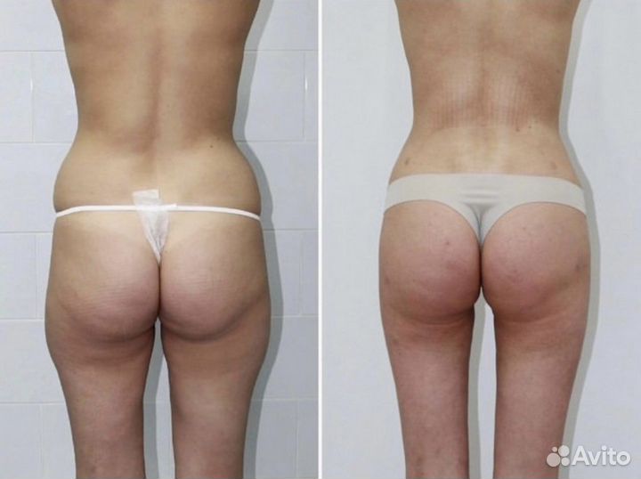 Пластическая хирургия