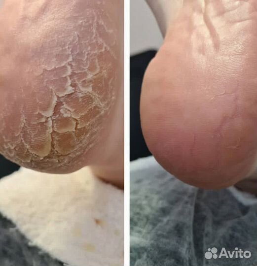 Курсы Подологии с 0+повышeние. Сертификаты