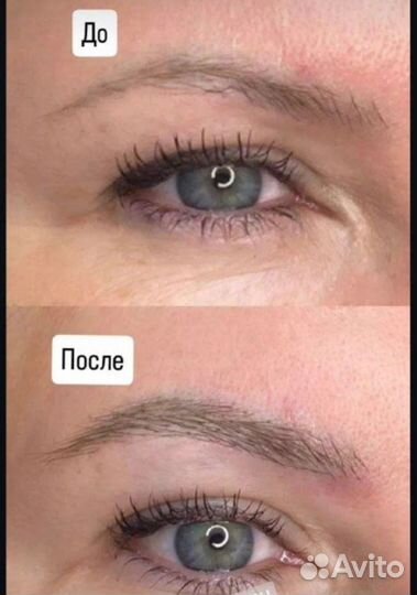 Реконструкция бровей BrowFlash