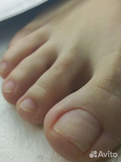 Эстетический педикюр