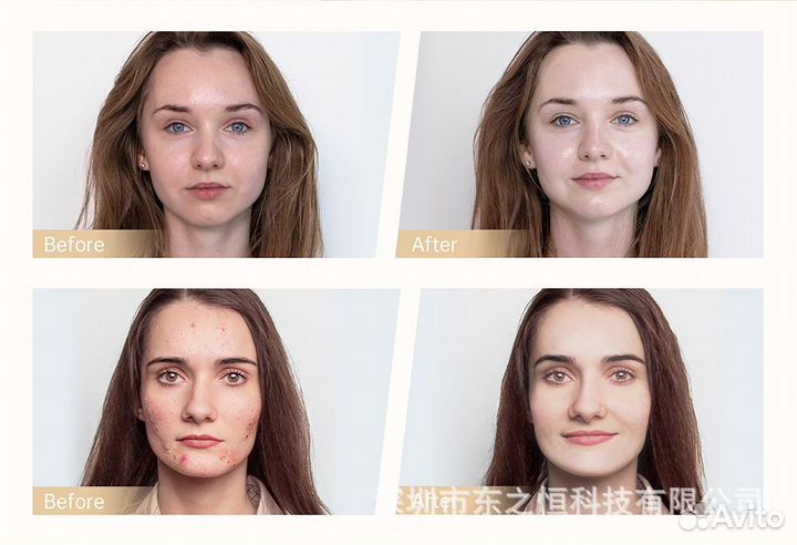 Нано микроиглы Омолаживание и увлажнение