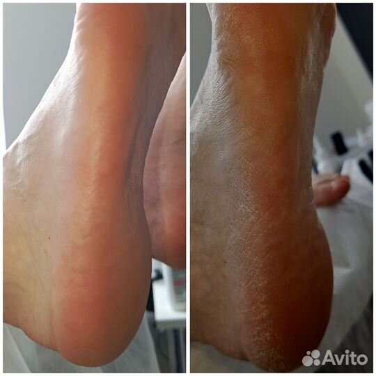 Маникюр - Педикюр