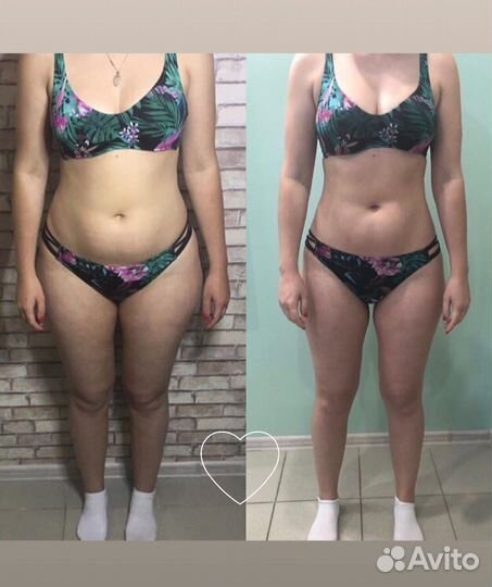 Вакуумно роликовый массаж,похудение