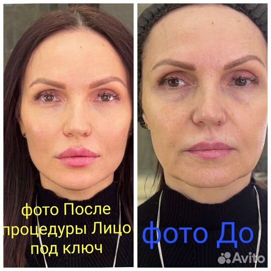 Услуги косметолога