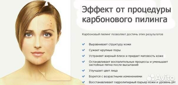 Карбоновый пилинг