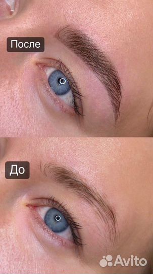 Брови ЖК Солнечный город