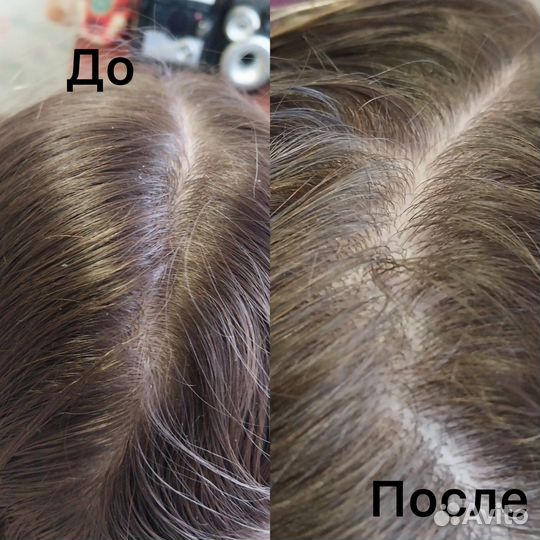 Пилинг для кожи головы