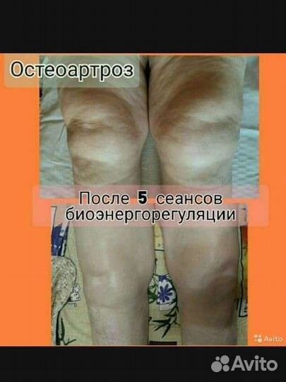 Массаж на биоэнергомассажере Fohow. Марма массаж