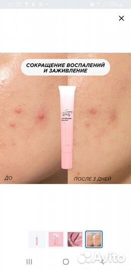 Гель концентрат