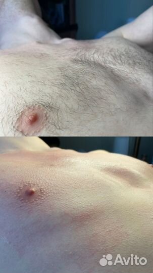 Депиляция шугаринг/ваксинг