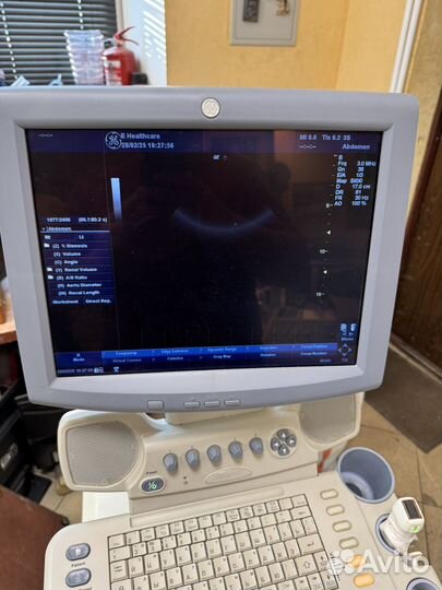Узи GE Logiq P5 узи аппарат GE