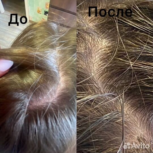 Пилинг для кожи головы