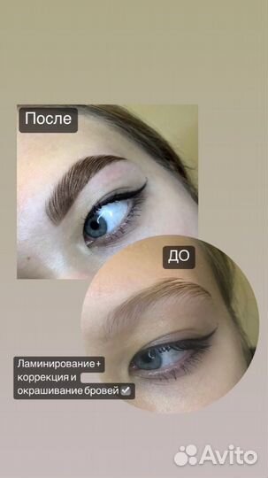 Бровист Кимры