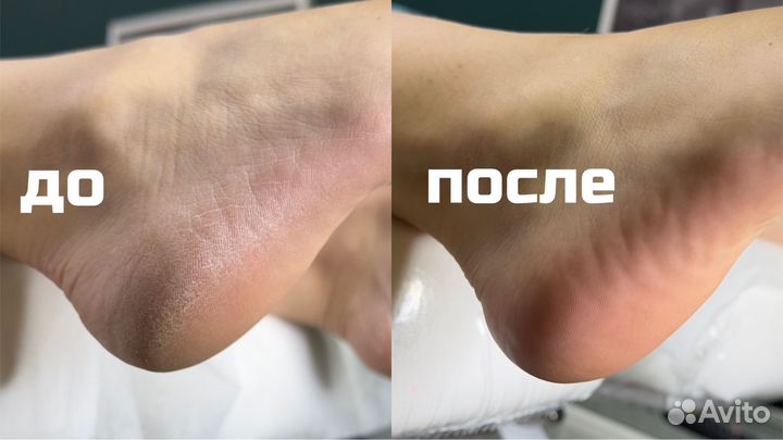 Маникюр и педикюр, Индустриальный Пермь