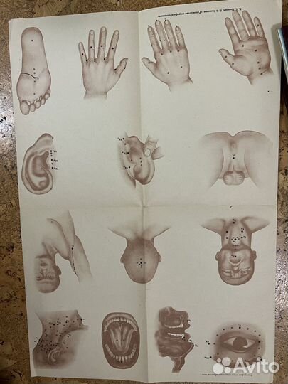 Книги медицина рефлексотерапия