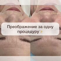 Косметолог. Чистка лица. Пилинг. Уход, Москва