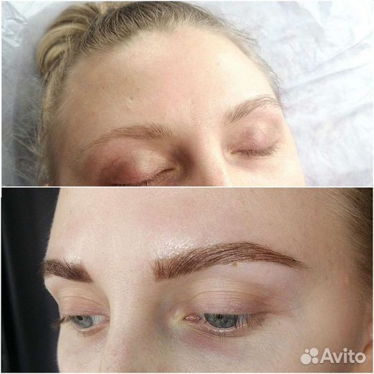 Архитектура бровей