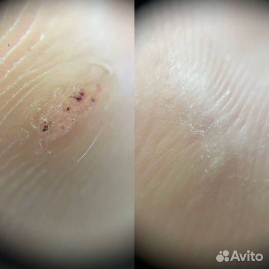 Услуги подолога